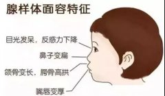 打鼾、鼻塞、大脑缺氧，宝宝腺样体肥大的后果，远比你想象的严重~