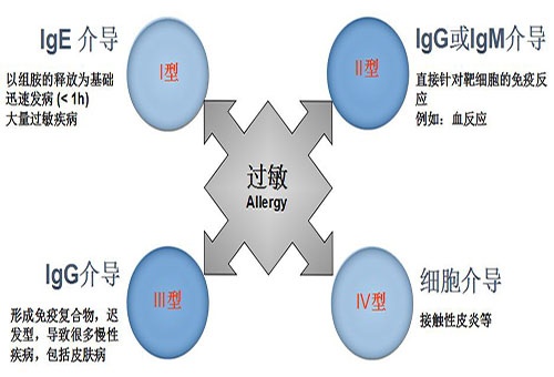 过敏性鼻炎