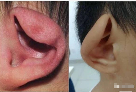 垂耳