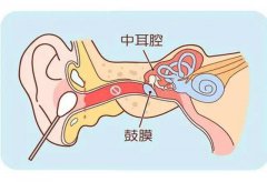 耳朵湿湿的还发痒，却没有挖出耳屎，这是怎么回事？