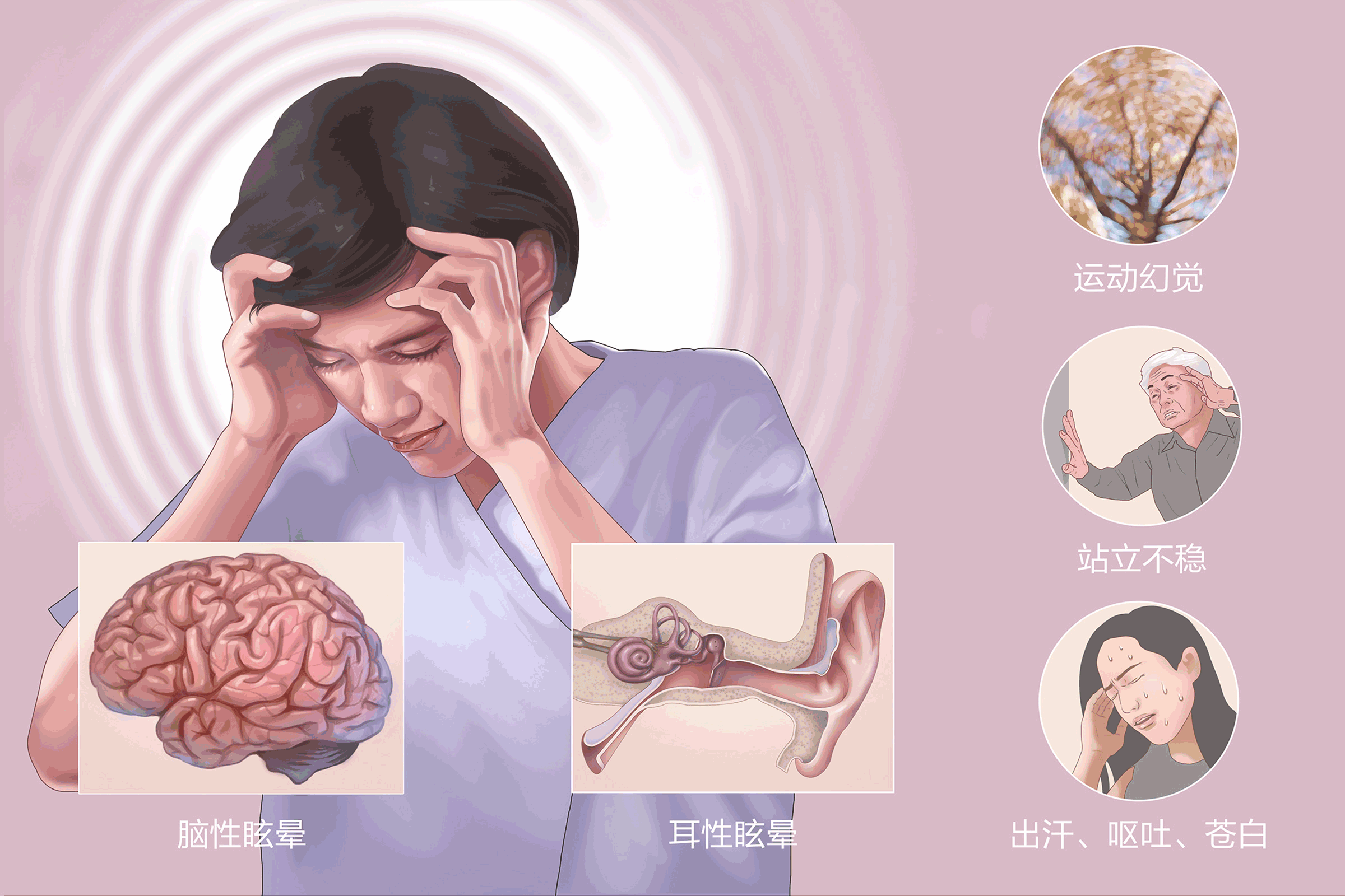 耳石症