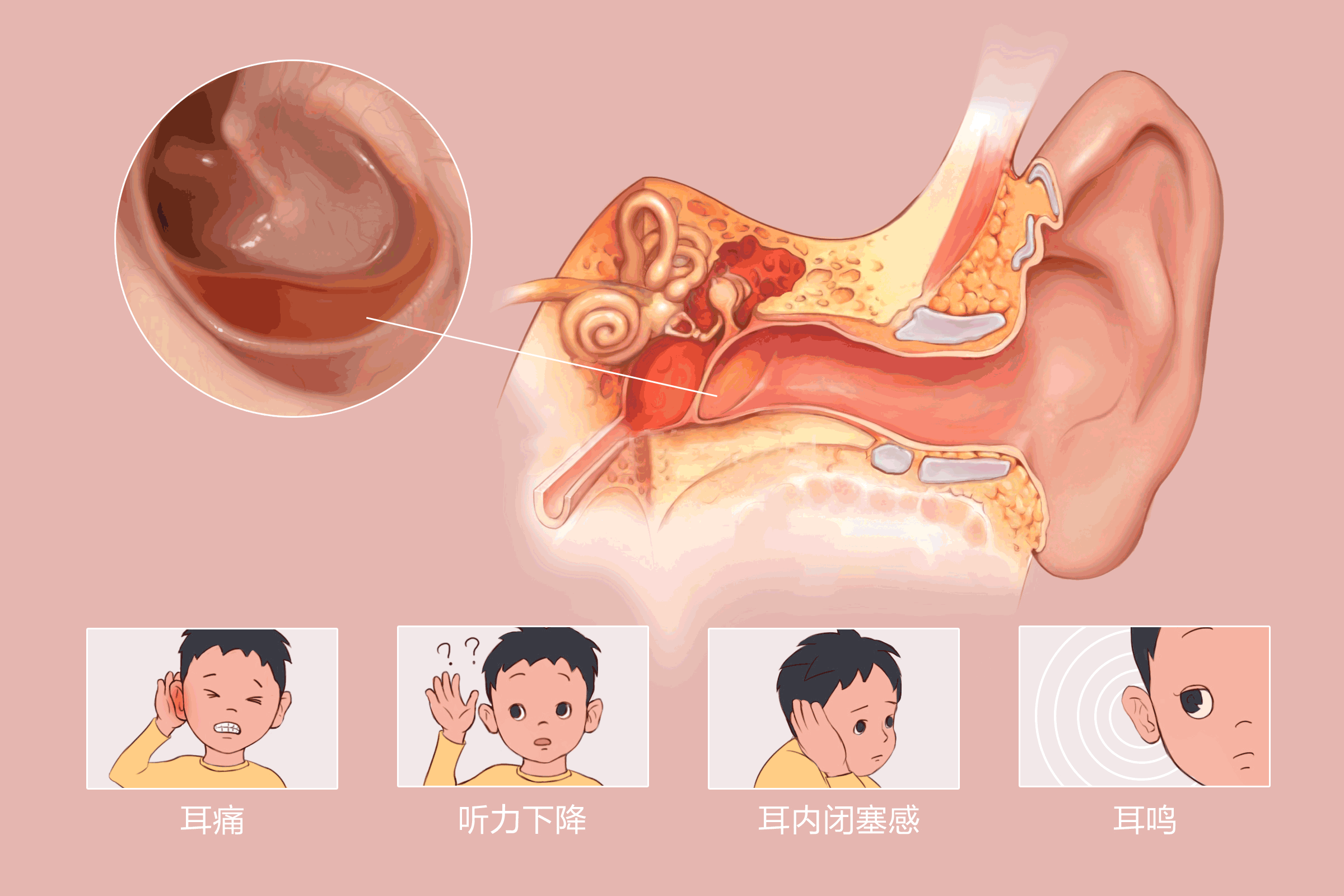 重庆中耳炎医院推荐