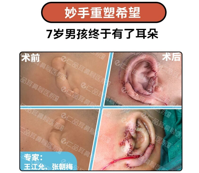 仁品医院正式启动小耳畸形寒假专项援助项目