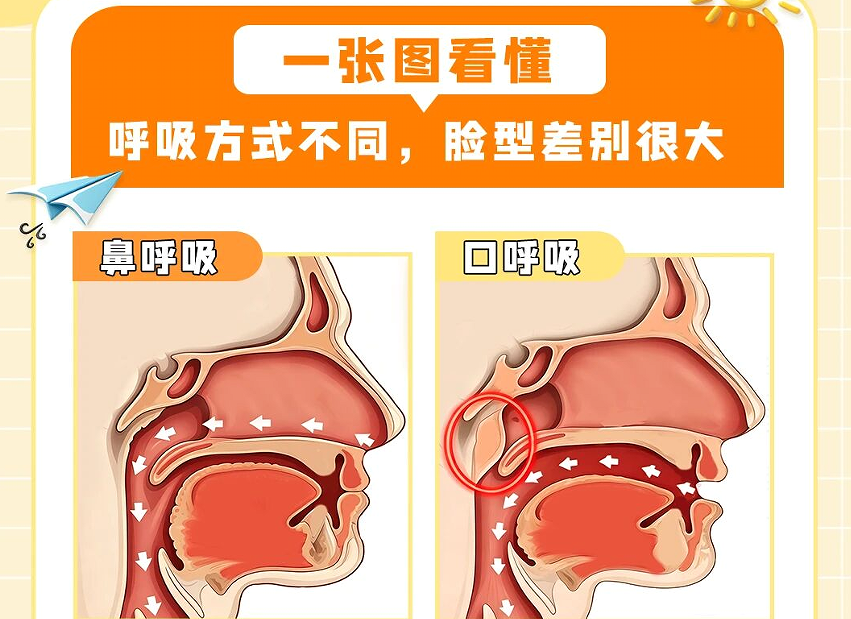 别让口呼吸毁了孩子颜值和健康，四步纠正→